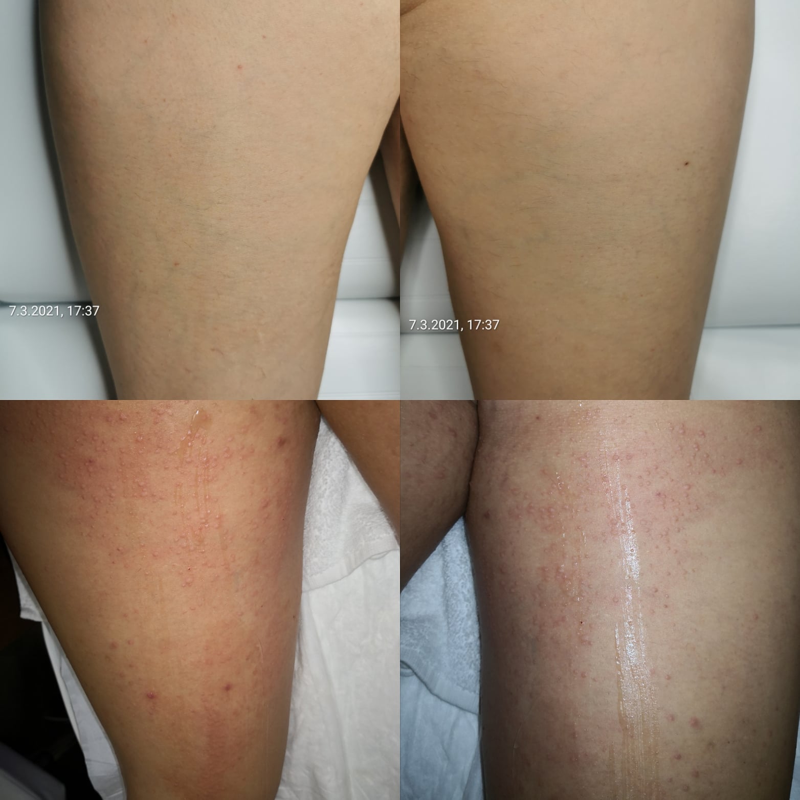 IMG_20210307_174940_159