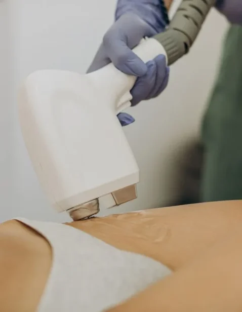 laser-epilation-hair-removal-therapy-1fhg